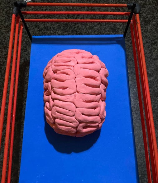cervello