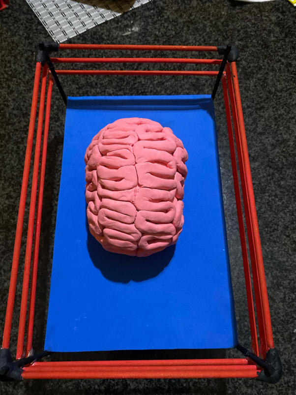 cervello