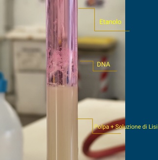 Estrazione del DNA